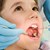 Много малко родители водят децата си на зъболекар