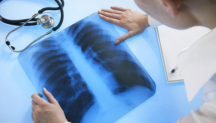 10 дни безплатни прегледи за туберкулоза ще направи Белодробната болница от 19  до 27 март