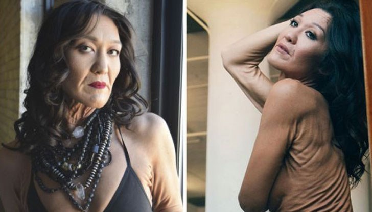 Младото момиче иска да покаже на целия свят, че няма от какво да се срамува