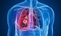 Половината от пациентите с рак на белия дроб не са пушачи