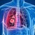 Половината от пациентите с рак на белия дроб не са пушачи