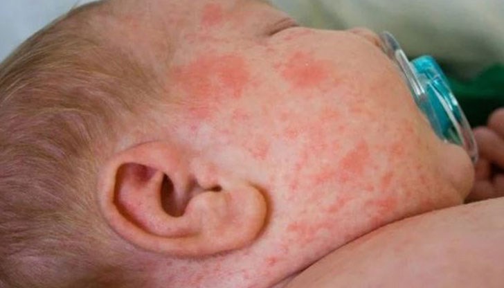 9-месечно бебе е сред починалите от заразата