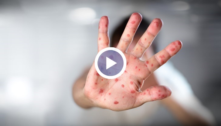 Причината е високият ръст на заболели през последната година