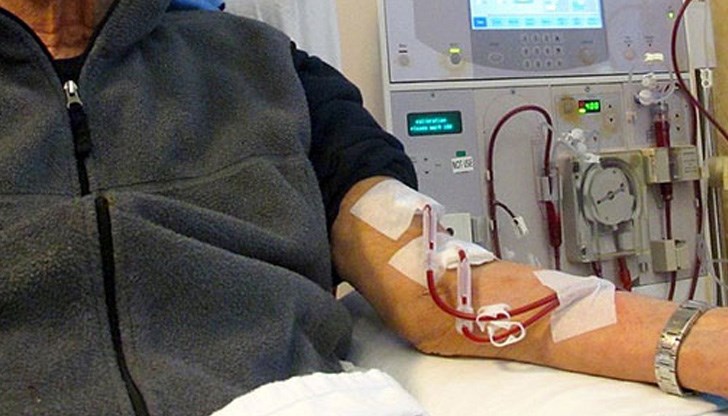Изкуствен бъбрек ще замести животоподдържащата диализа