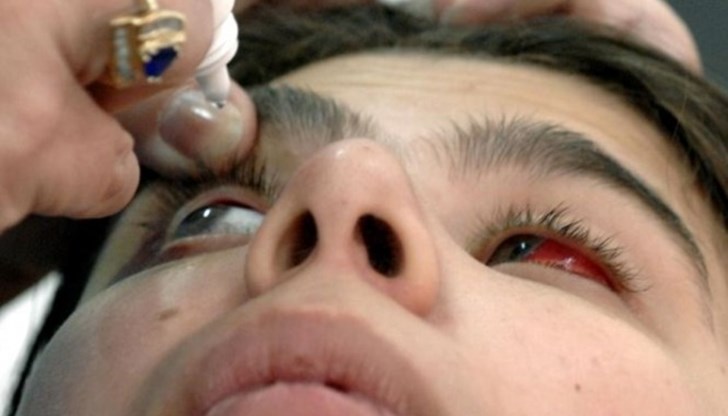 Мъжът се лекувал сам с обезболяващ медикамент в двете очи / Снимката е илюстративна Мъжът се лекувал сам с обезболяващ медикамент в двете очи / Снимката е илюстративна