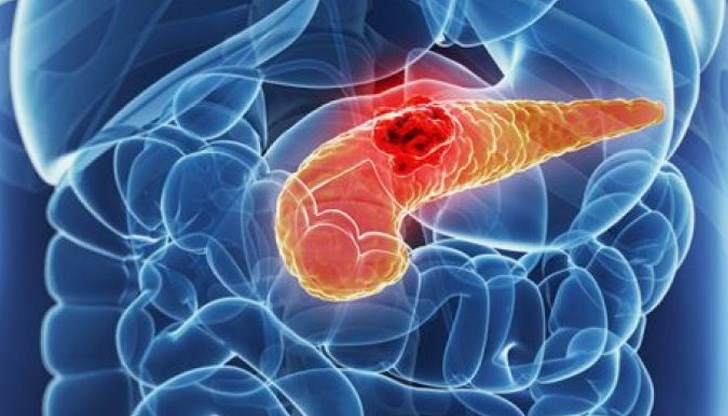 Болестта протича много бързо, но има ранен признак, който може да подскаже за наличието й Болестта протича много бързо, но има ранен признак, който може да подскаже за наличието й