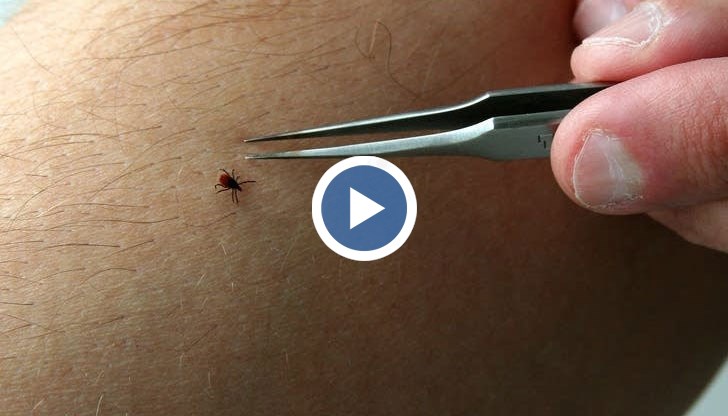 Защо ваденето на кърлеж в спешните отделения се заплаща?