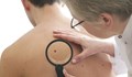 Лекари съветват веднъж годишно да се преглеждаме за рак на кожата