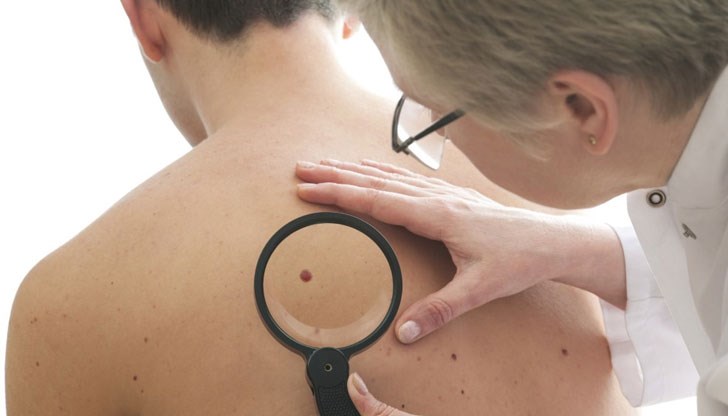 Силните слънчеви изгаряния в детска възраст, използването на солариуми и прекомерното излагане на UV радиация повишават риска от меланом Силните слънчеви изгаряния в детска възраст, използването на солариуми и прекомерното излагане на UV радиация повишават риска от меланом
