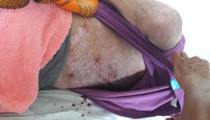 За премиера, болниците и медиите – Босият е в „добро здравословно състояние“! Доказано добро!