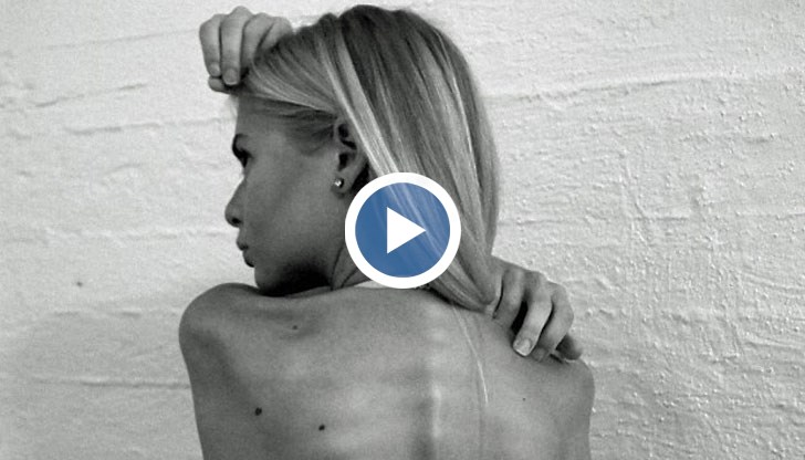 Трагичният случай с 22-годишната Жанет отново повдигна въпроса защо млади момичета гладуват до смърт