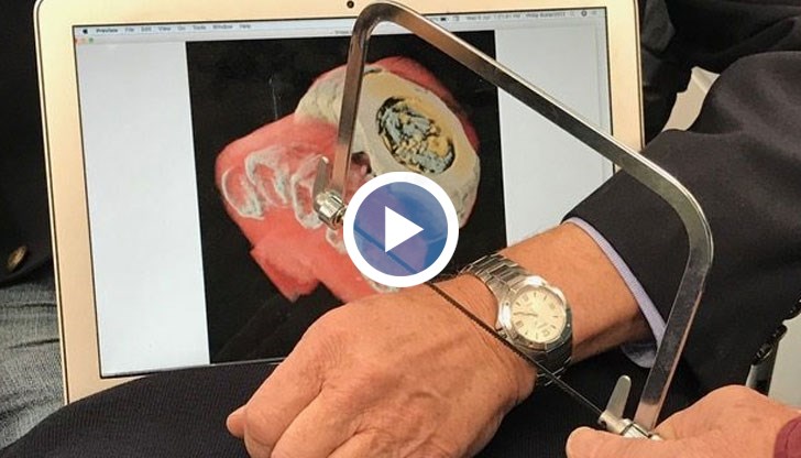 Новата техника ще помогне на лекарите да поставят по-точни диагнози на своите пациенти