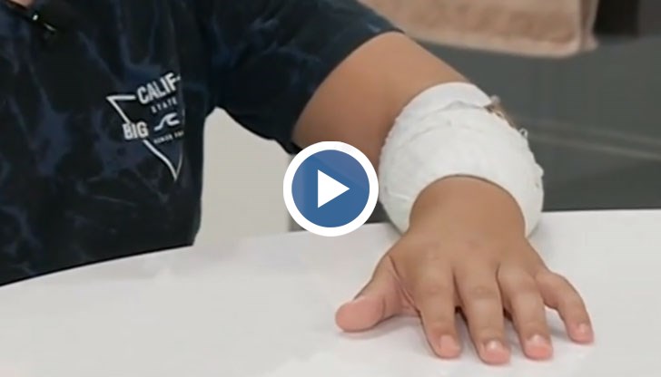 11-годишният Калоян изгори ръката си, изпълнявайки инструкциите на опасна игра от интернет