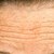 Дълбоките бръчки на челото разкриват рискове за здравето