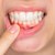 Натурални начини за премахване на зъбния камък