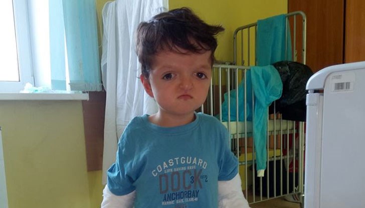 Момченцето страда от рядко заболяване, наречено Болестта на счупените кукли