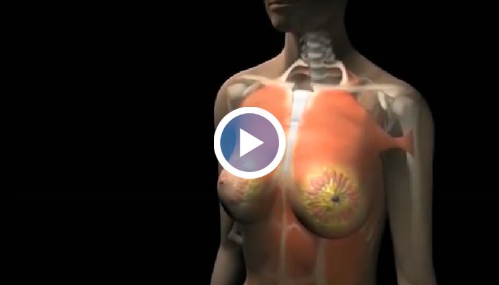 Процедурата е безболезнена и щадяща за пациентките