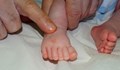 Оперираха успешно бебе с 24 пръста в болница „Дева Мария“