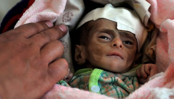 От глад, инфекции и болести, които по принцип нямат фатален край От глад, инфекции и болести, които по принцип нямат фатален край