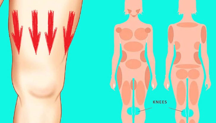 Защо се натрупват тлъстини в областта на коленете и как да се справите с тях