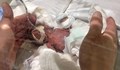 Изписаха момченцето, родено с най-ниско тегло в света