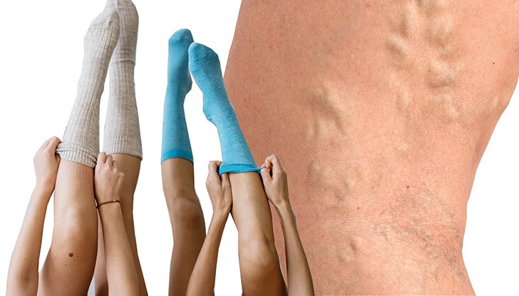 Проблемът засяга все по-често младите хора, работещи в офис и водещи застоял начин на живот