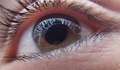 Глаукома - тихият крадец на зрението