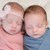 Полуидентични близнаци са се родили в Австралия