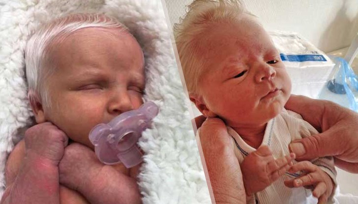 Лекарите били удивени от сивите коси на детето