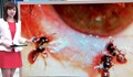 Лекари извадиха 4 живи пчели от окото на жена