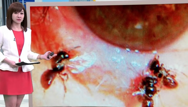 Насекомите се хранели от сълзите ѝ Насекомите се хранели от сълзите ѝ