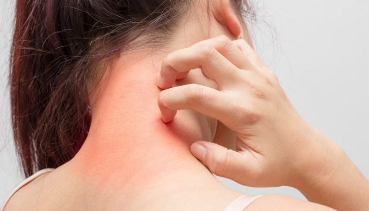 Витамин А е важен за създаването и възстановяването на кожните клетки Витамин А е важен за създаването и възстановяването на кожните клетки