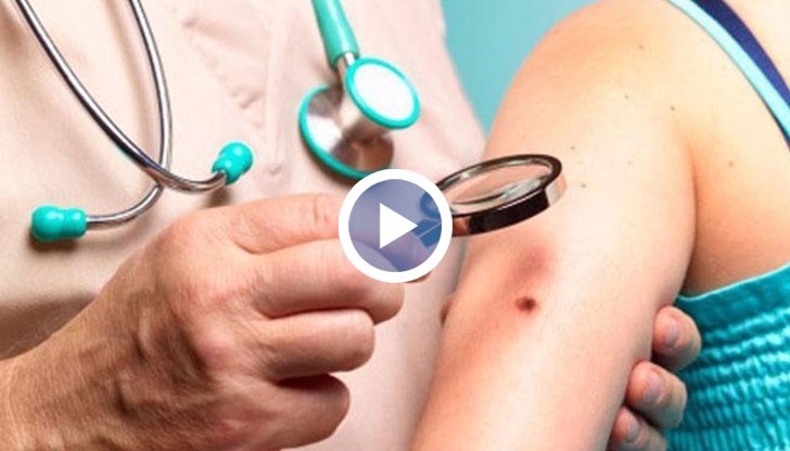 Д-р Катя Паскова разкри какви са симптомите и как да се предпазим