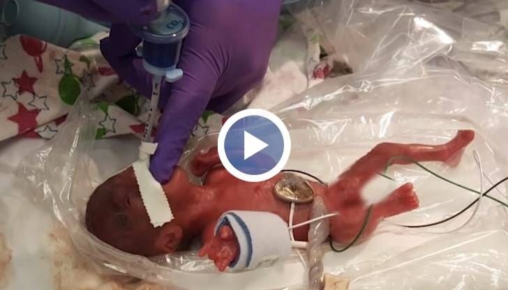 Момиченцето се е родило едва 245 грама