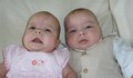 Учени откриха трети вид близнаци