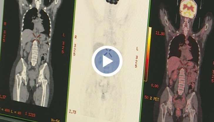 Надеждите са светът да започне да използва в практиката българското откритие