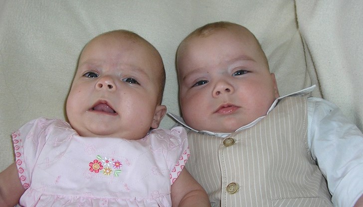 Става дума за междинна форма между еднояйчни и двуяйчни близнаци