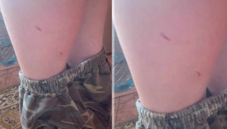 Майката на детето се закани, че ще направи всичко възможно да премахне кучетата от района Майката на детето се закани, че ще направи всичко възможно да премахне кучетата от района