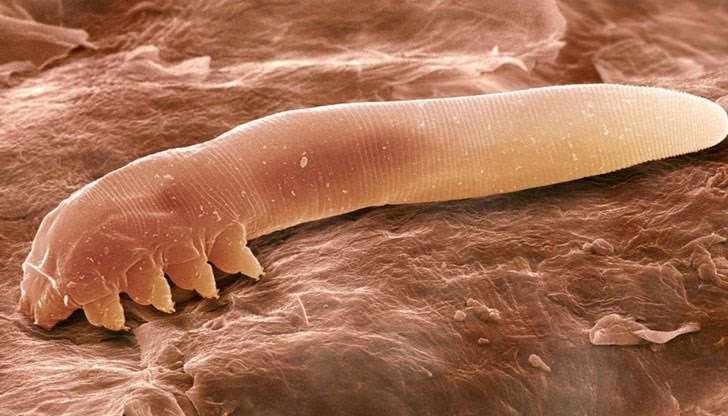 Паразитите сами по себе си са достатъчно сериозна заплаха за здравето ни, защото могат да предизвикат увреждания почти навсякъде в тялото Паразитите сами по себе си са достатъчно сериозна заплаха за здравето ни, защото могат да предизвикат увреждания почти навсякъде в тялото