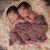 Жена с перфориран апендикс роди близнаци