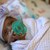 Сейби - най-малкото оцеляло бебе в света