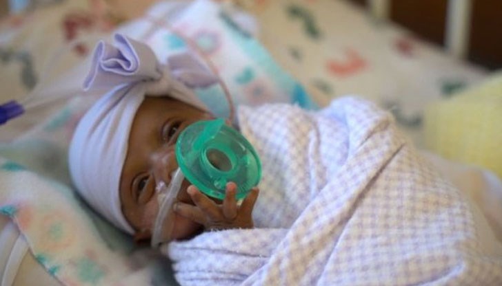 Момиченцето се ражда едва 245 грама