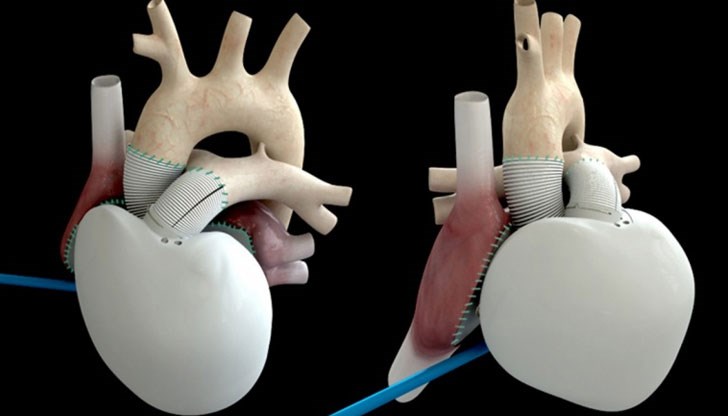 Това ще доведе до нова ера в трансплантирането на органи