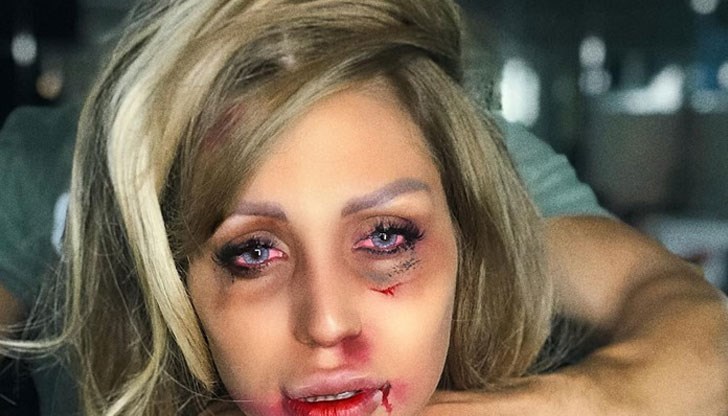 Джулиана Гани публикува снимки с обезобразено лице