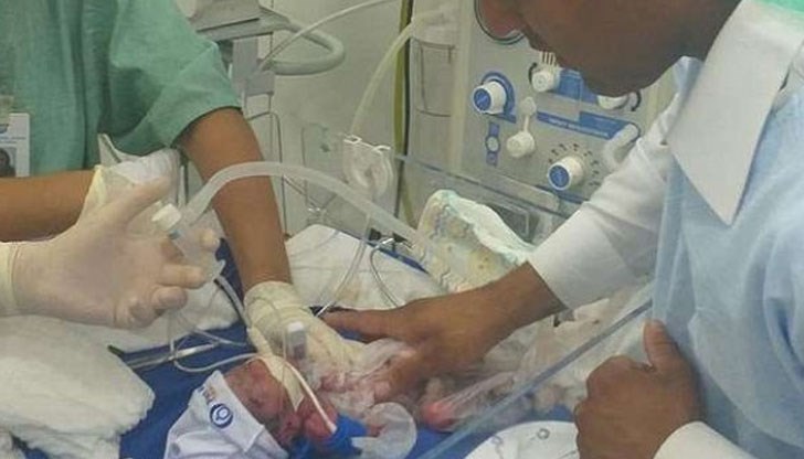 Лекарите успяха да спасят бебето ѝ, което тежи едва 930 грама