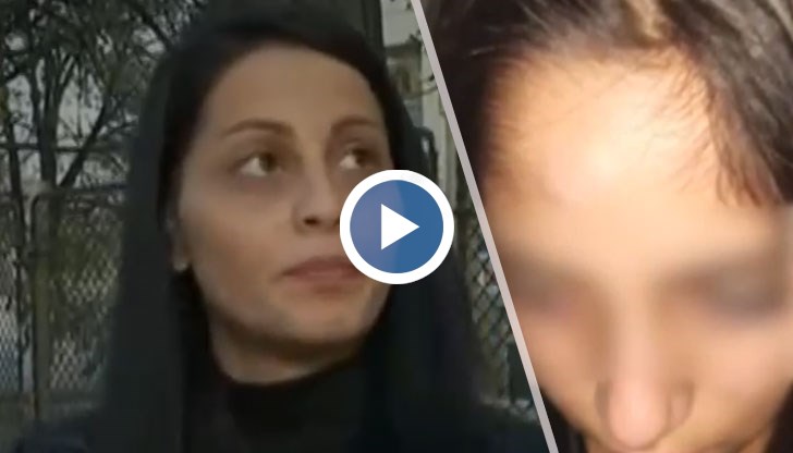 Пострадалото момиче е с хематом на главата