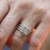 Лекарка отряза пръста на починала жена заради диамантен пръстен
