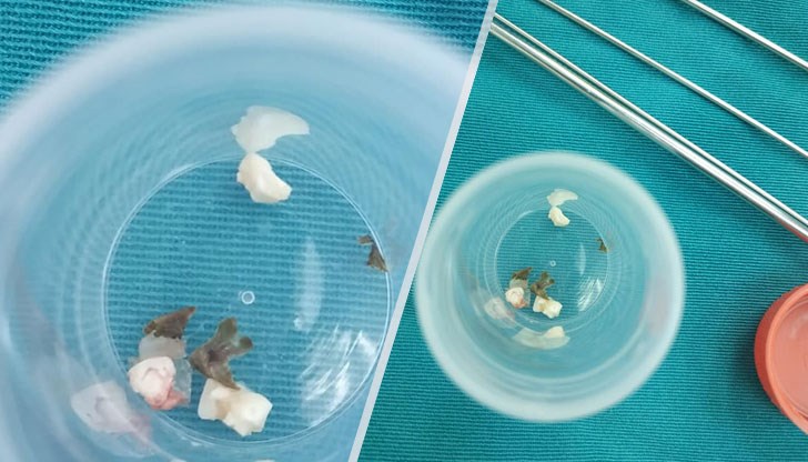 Това е станало благодарение на голям екип в УМБАЛ "Света Марина" - Варна