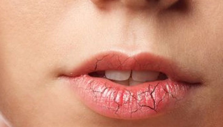 Човешкият папиломен вирус причинява приблизително 73% от рака на устата