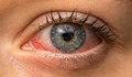Изкуствените мигли водят до кръвоизливи в очите